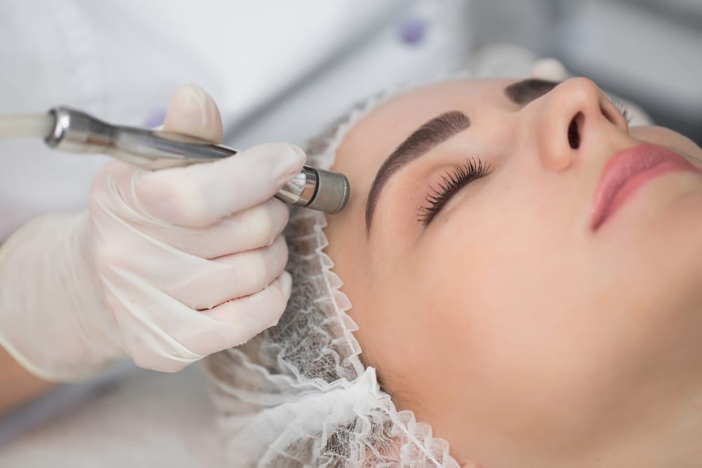 آموزش آرایشگری زنانه فنی حرفه ای تهران، میکرودرمابراسیون یا میکرودرم ابریژن 
