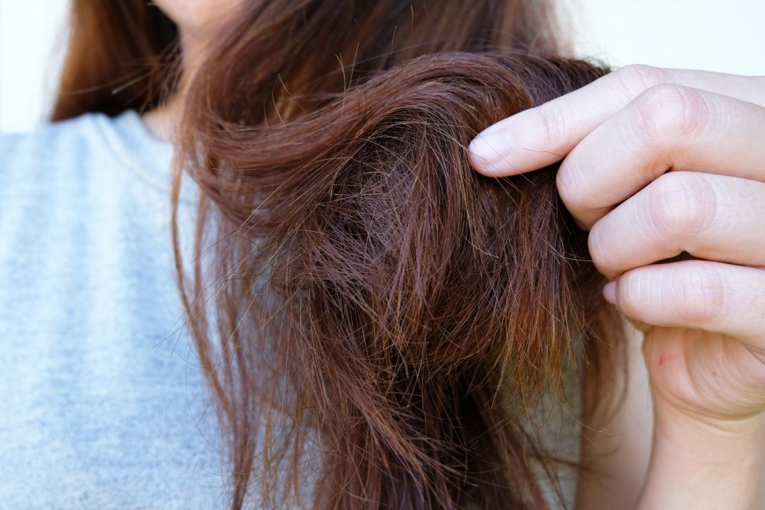 درمان موهای چرب و نازک ، مراقبت های موی سر چرب
